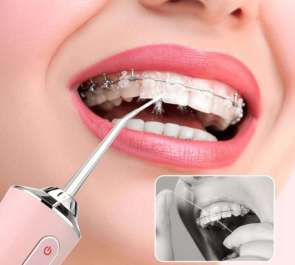 Der leichte elektrische Schall-Zahnsteinreiniger